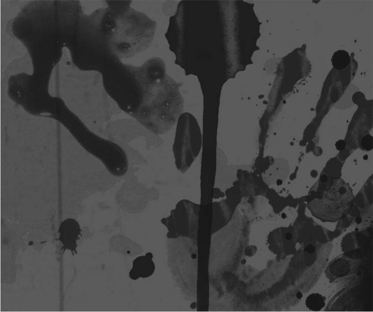 Ağzımıza Bulaşan Kan